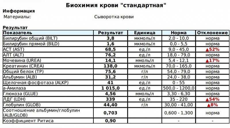 «возьмёшь» или «возмёшь»: как правильно писать слово?